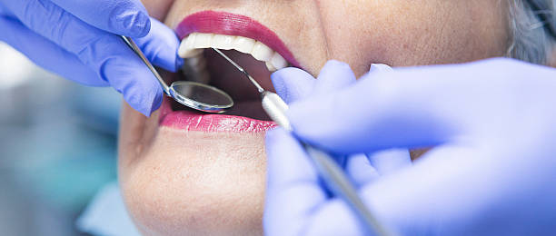Best Knocked-Out Tooth Emergency  in Del Norte, CO